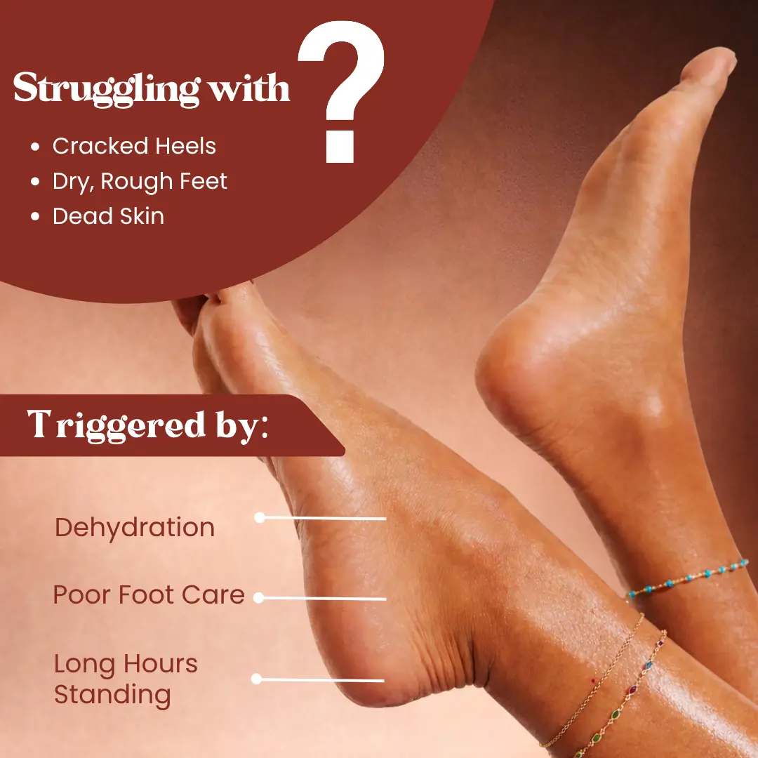 Foot Crack Cream Roll On - Image 5